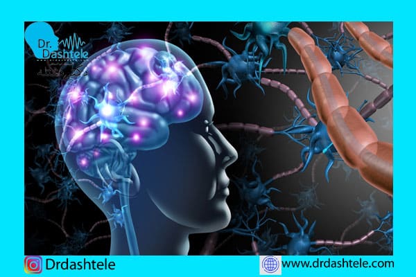 تحریک الکتریکی مغز در درمان سکته مغزی